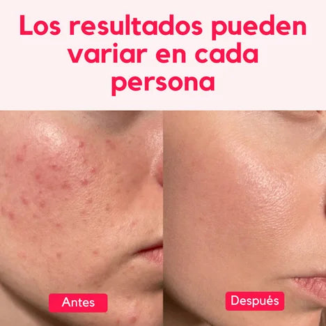 Serum Anua