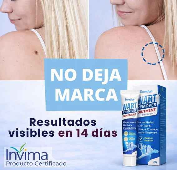 Removedor de Verrugas